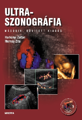 Ultraszonográfia - Második, bővített kiadás