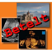 V. Nemzetközi Gyakorlati Ultrahang Tanfolyam - V. Nemzetközi Gyakorlati&nbsp;Ultrahang Tanfolyam (2012. szeptember 13-15.) A létszám betelt! További jelentkezéseket nem áll módunkban elfogadni!
